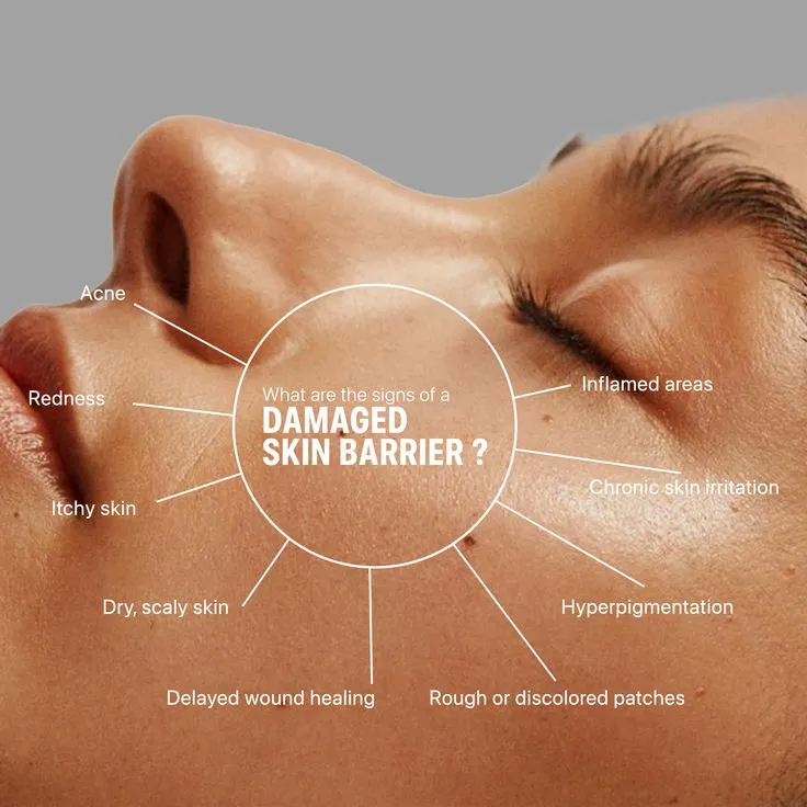 Skin Barrier Repair Care | Soothing & Hydration  at Kritika Ladies Parlour Patna