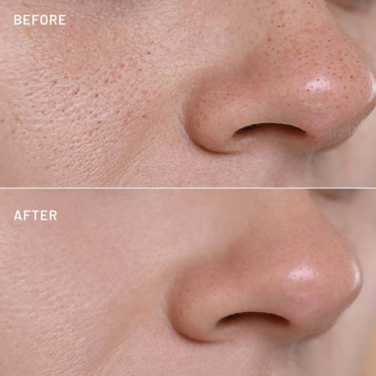 Open Pores Care | Pore Refining Treatment  at Kritika Ladies Parlour Patna